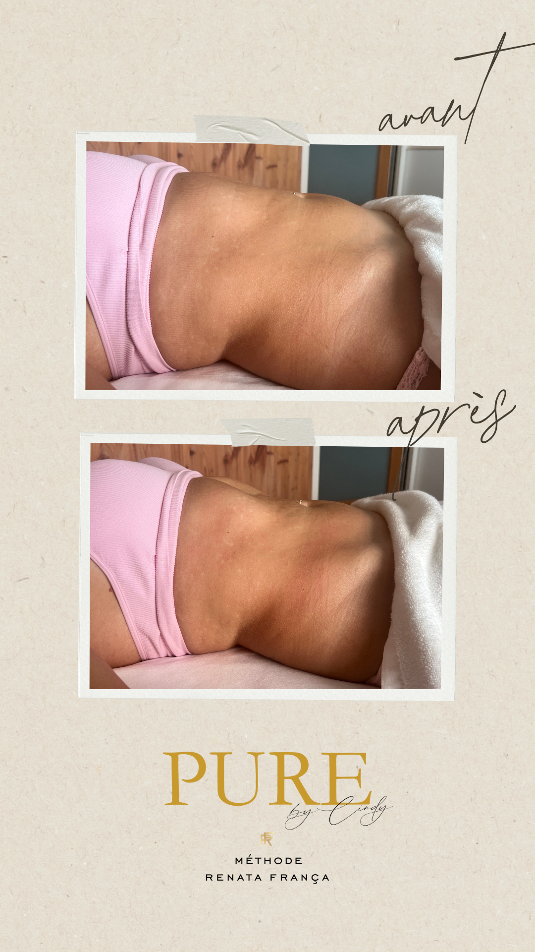 Copie de Post Instagram Avant Après Cosmétique Beauté Collage Photo Beige Minimaliste -2