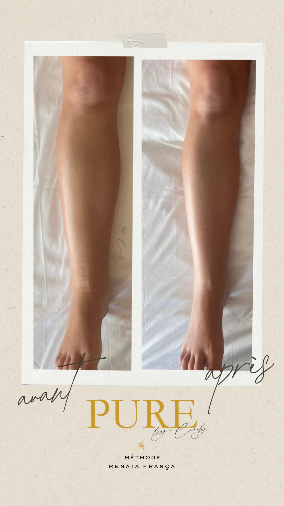 Post Instagram Avant Après Cosmétique Beauté Collage Photo Beige Minimaliste -8