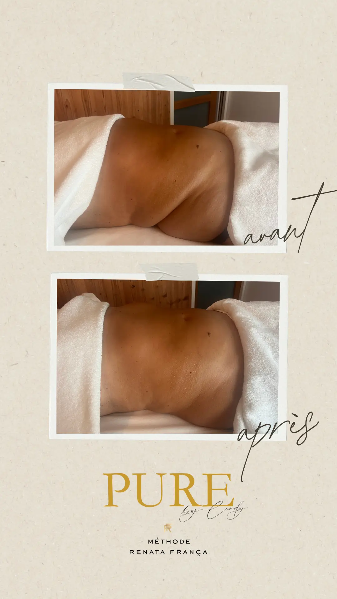 Avant aprés Remodelage renata franca annemasse machilly