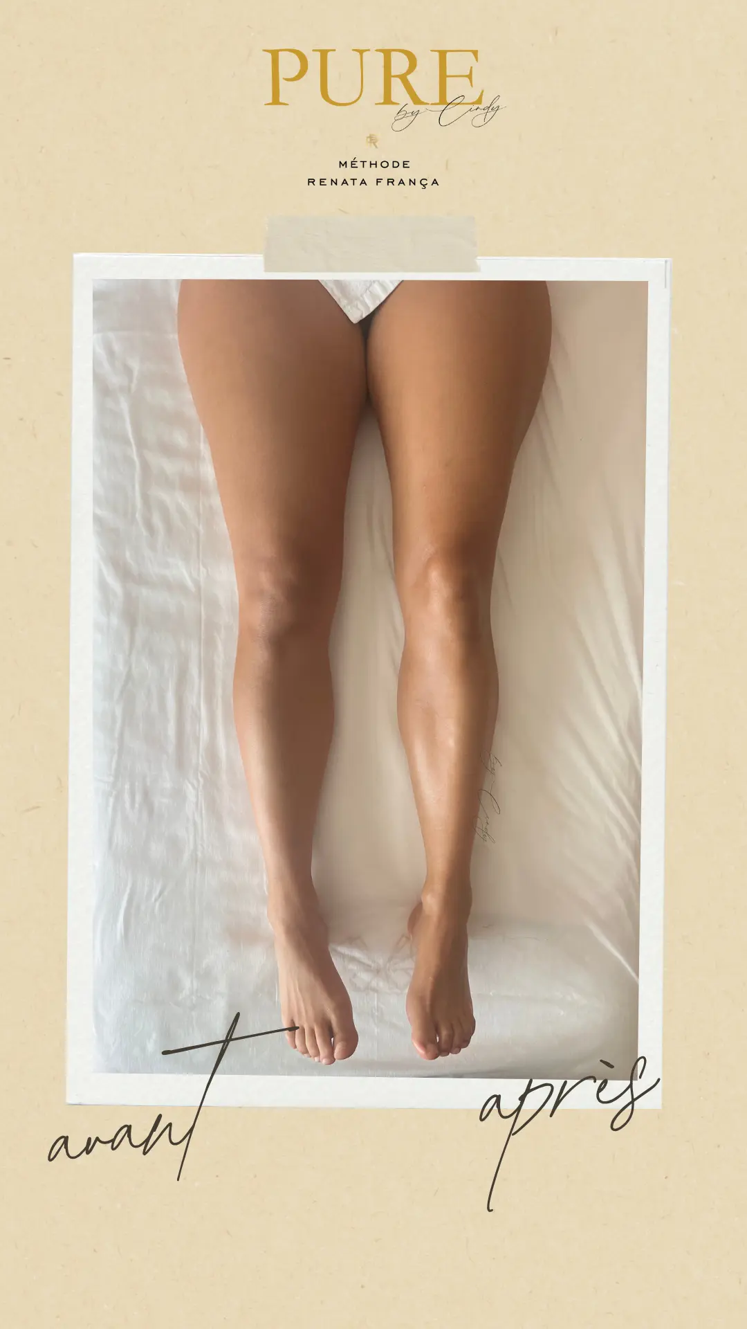 Drainage lymphatique avant aprés geneve