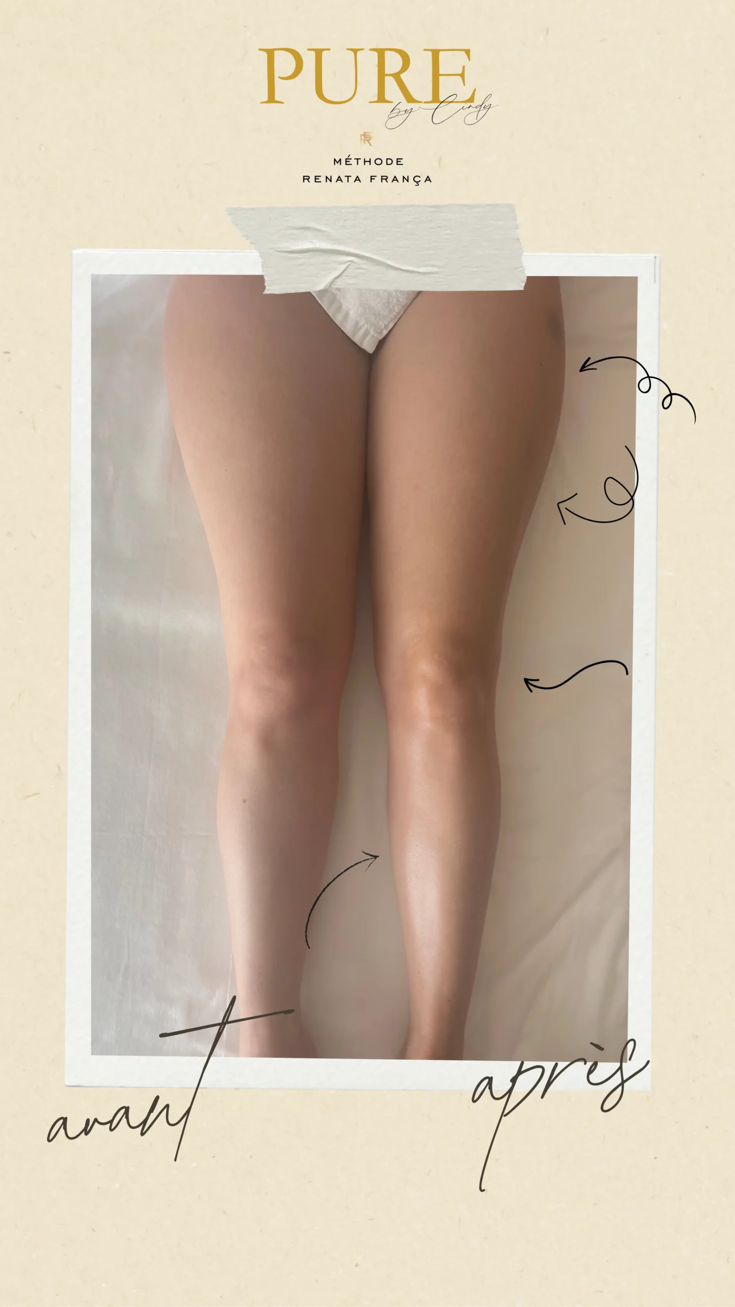 Drainage lymphatique post accouchement geneve