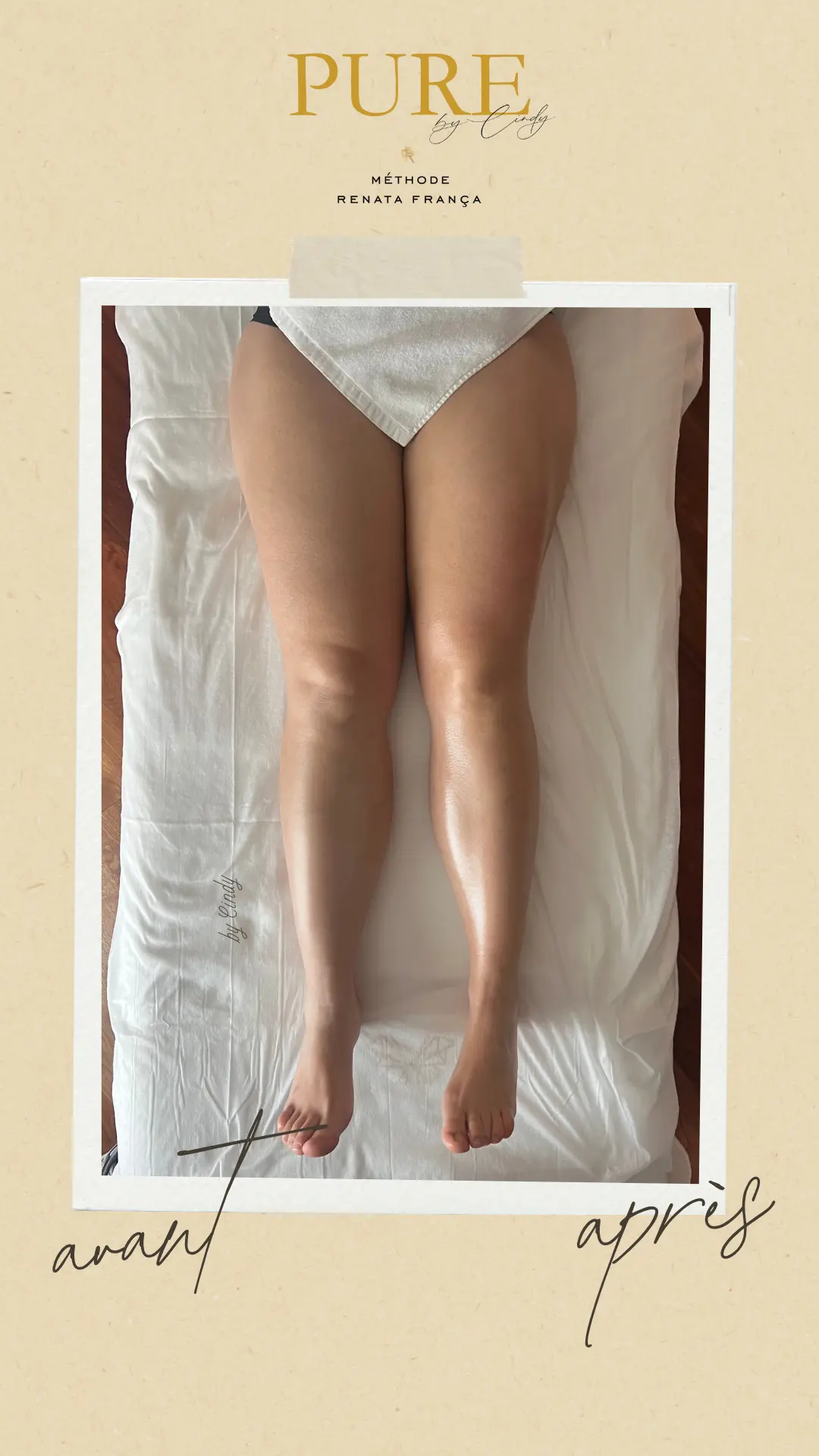 Avant-aprés Miracle Touch