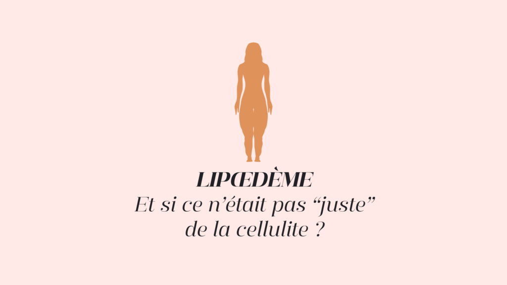 Lipoedème douleur drainage lymphatique Genève