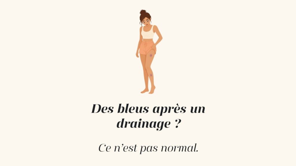 Illustration d'une femme surprise qui découvre des bleus sur sa cuisse et son tibia : des bleus après un drainage lymphatique, ce n'est pas normal. PURE by Cindy, Machilly (74)